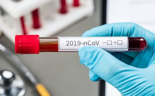 ΠΑΝΤΑ ΣΕ ΕΤΟΙΜΟΤΗΤΑ ΑΠΕΝΑΝΤΙ ΣΤΗΝ ΑΠΕΙΛΗ ΤΗΣ ΠΑΝΔΗΜΙΑΣ Ο ΔΗΜΟΣ ΝΕΑΣ ΣΜΥΡΝΗΣ