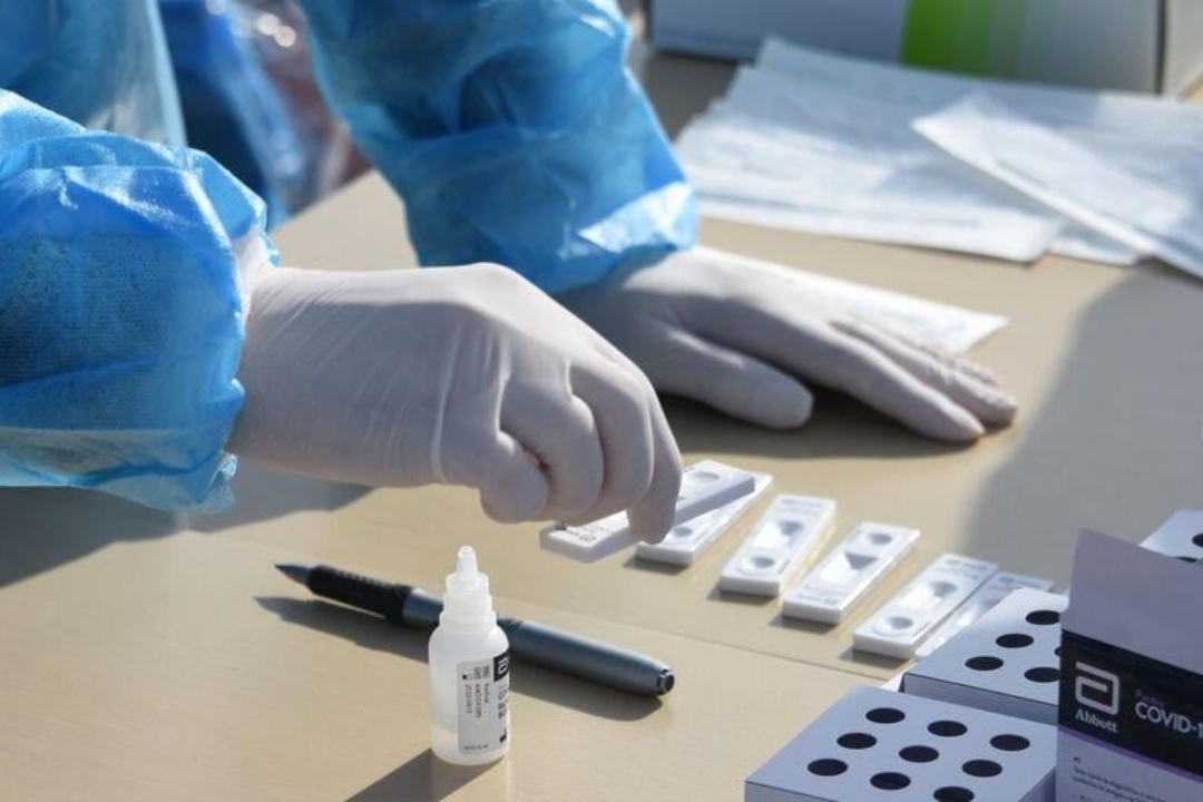 RAPID TEST ΑΠΟ ΤΟΝ ΕΟΔΥ ΤΟ ΣΑΒΒΑΤΟ 26 ΦΕΒΡΟΥΑΡΙΟΥ ΣΤΟ Β’ ΚΑΠΗ (Σταδίου 32 – 34)